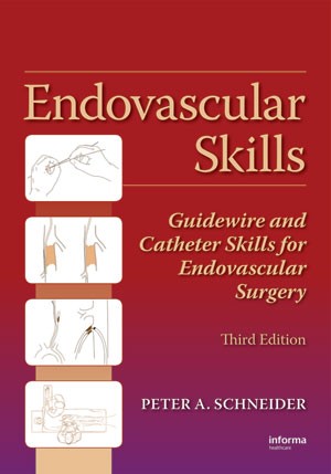 Endovascular Skills : Guidewire and Catheter Skill for Endovascular Surgery