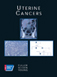 Uterine Cancer - American Cancer Society Atlas of Clinical Oncology