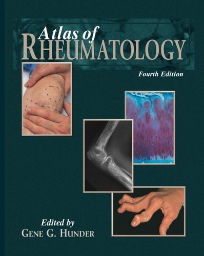 Atlas of Rheumatology (Hardcover)-4판