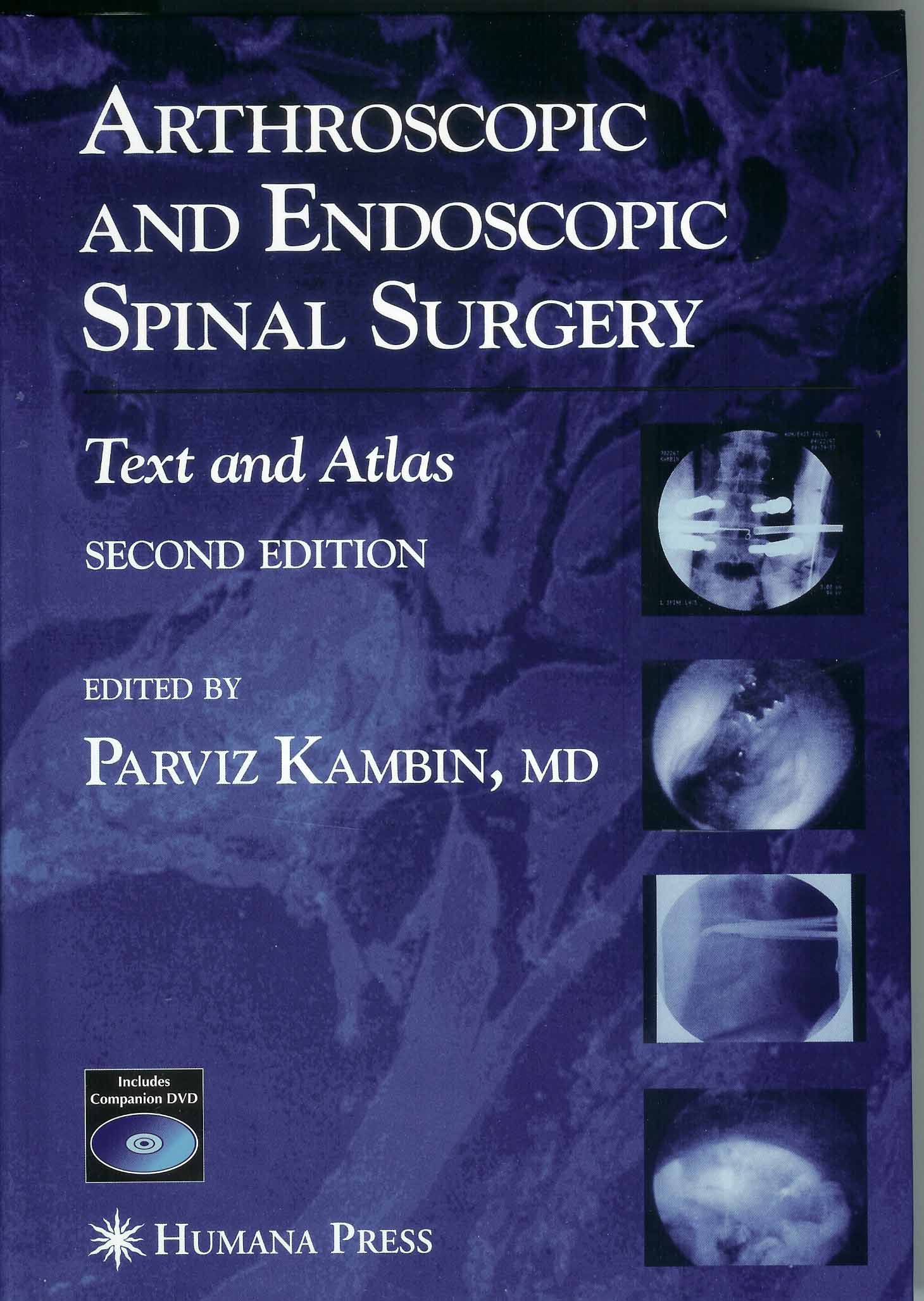 Arthroscopic and Endoscopic Spinal Surgery-2판