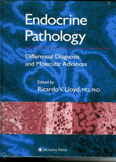Endocrine Pathology : Differential Diagnosis and Molecular Advances