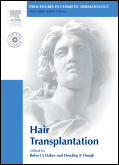 Procedures in Cosmetic Dermatology Series:Hair Transplantation(With DVD)(pcds)