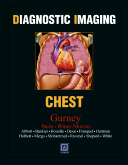 Diagnostic Imaging : Chest