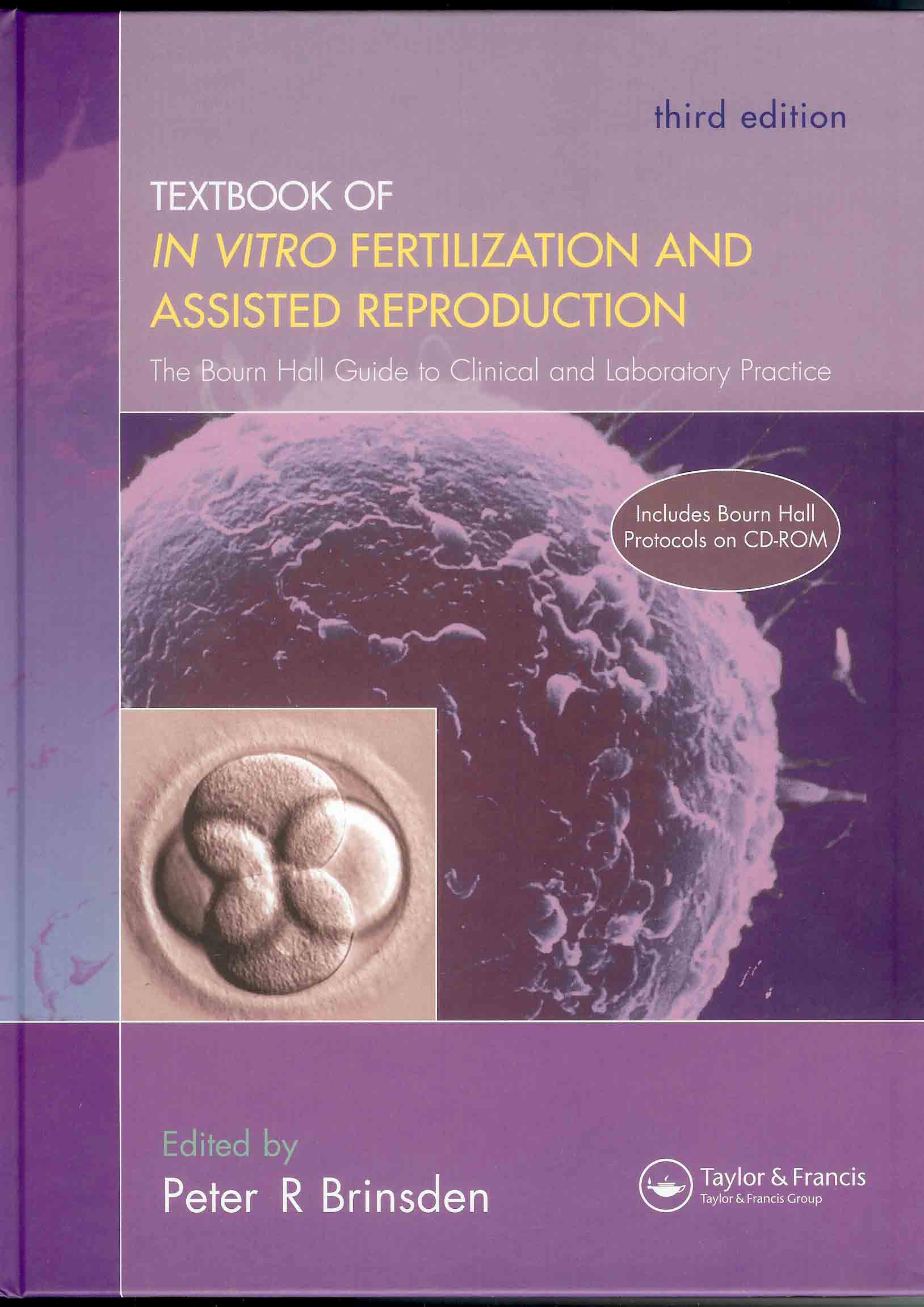 Textbook of In Vitro Fertilization and Assisted Reproduction(ivf)-cd포함