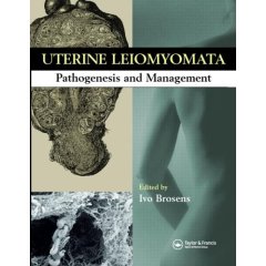 Uterine Leiomyomas: Pathogenesis and Management (Hardcover)