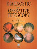 Diagnostic and Operative Fetoscopy-1판