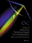 Atlas of Multiplane Transesophageal Echocardiography (2 Vol Set)
