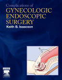 Complications of Gynecologic Endoscopic Surgery