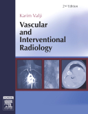 Vascular and Interventional Radiology-2판