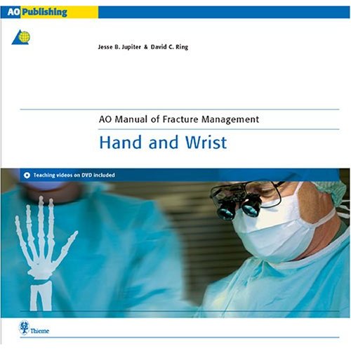 AO Manual of Fracture Management - Hand and Wrist (Hardcover)