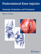 Posterolateral Knee Injuries: Anatomy Evauation and Treatment (Hardcover)
