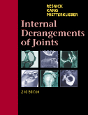 Internal Derangements of Joints-2판