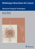 Multiorgan Resections for Cancer: Advanced Surgical Techniques (Hardcover)