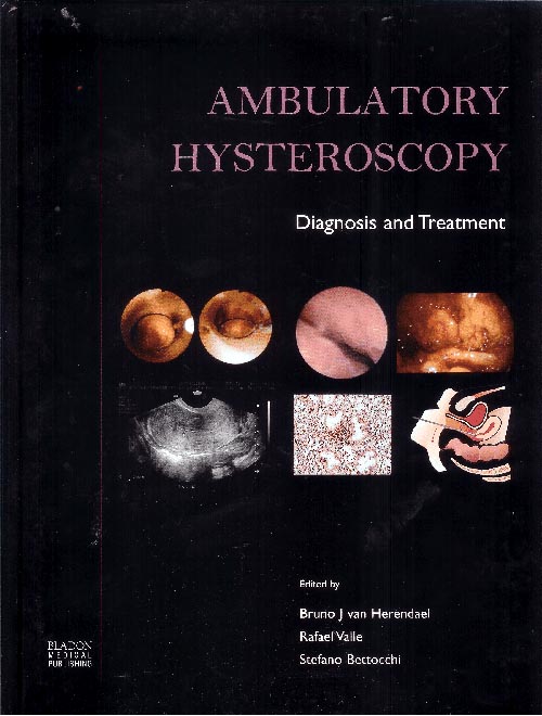 Amburatory Hysteroscopy : Diagnosis and Treatment