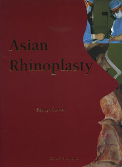 Asian Rhinoplasty