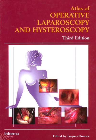 Atlas of Operative Laparoscopy and Hysteroscopy 3e