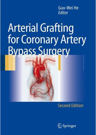 Arterial Grafting for Coronary Artery Bypass Surgery 2e
