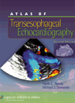 Atlas of Transesophageal Echocardiography 2e