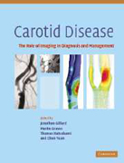 Carotid Disease:The Role of Imaging in Diagnosis and Management