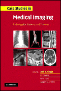 Case Studies in Medical Imaging:Radiology for Students and Trainees