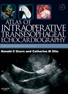 Atlas of Intraoperative Transesophageal Echocardiography: Surgical and Radiologic Correlations Textbook with DVD