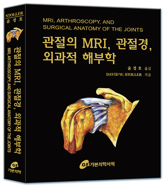 관절의 MRI 관절경 외과적 해부학