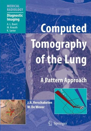 Computed Tomography of the Lung:A Pattern Approach