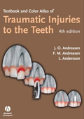 Color Atlas of Traumatic Injuries to the Teeth 4/e