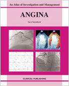 Angina:An Atlas of Investigation and Management