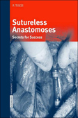 Sutureless anastomoses:Secrets for success