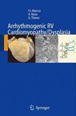 Arrhythmogenic right ventricular cardiomyopathy/dysplasia