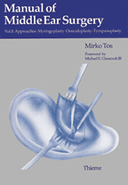 Manual of Middle Ear Surgery : Volume 1: Approaches Myringoplasty Ossiculoplasty and Tympanoplasty(I.E)