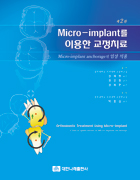 Micro-implant를 이용한 교정치료(제2판)