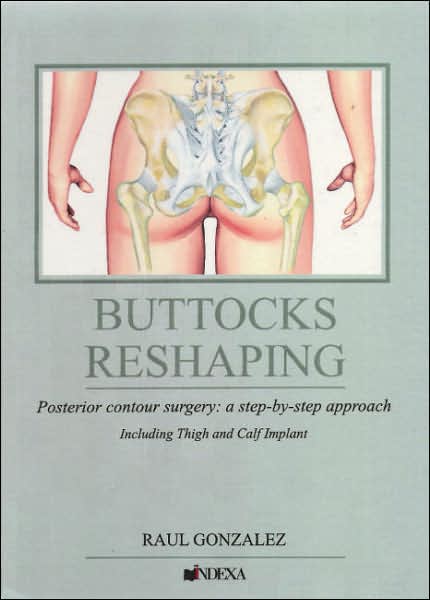 Buttocks Reshaping - a step-by-step approach to posterior contour surgery including thigh and calf implant