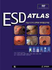 ESD Atlas 시술기구의 선택과 부위별공략법 with DVD