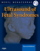 Ultrasound of Fetal Syndromes-2판-Text with DVD
