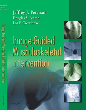 Image Guided Musculoskeletal Intervention