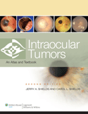 Intraocular Tumors : An Atlas and Text