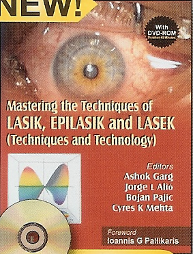 Mastering the Techniques of LASIK EPILASIK and LASEK  Free DVD