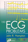 150 ECG Problems 2/e