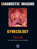 Diagnostic Imaging : Gynecology