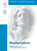 Procedures in Cosmetic Dermatology Series: Blepharoplasty (with DVD)(pcds)