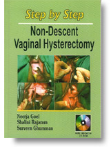Step by Step Non-Descent Vaginal Hysterectomy