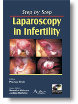 Step by Step Laparoscopy in Infertility