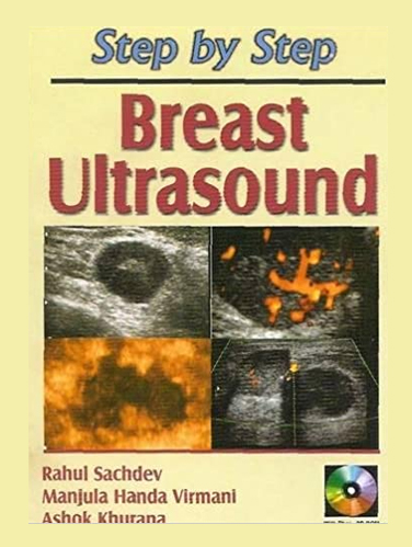 Step by Step Breast Ultrasound