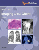 Imaging of the Chest(2Vols)