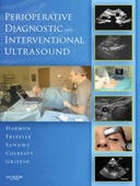 Perioperative Diagnostic and Interventional Ultrasound(with DVD)