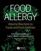 Food Allergy: Adverse Reactions to Foods and Food Additives 4/e