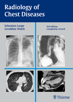 Radiology of Chest Diseases-3판