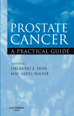 Prostate Cancer : A Practical Guide